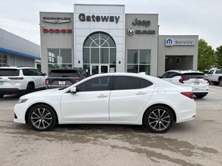 2015 Acura TLX V6 Tech